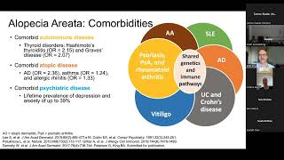 Alopecia areata - Brett King, MD, PhD