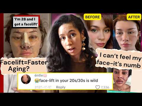 Are Facelifts the New Botox? Because This Is Wild