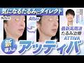 【たるみを内側から引き締める】最新高周波治療アッティバ徹底解説