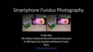 Smartphone Fundus Photography - Introduction screenshot 2