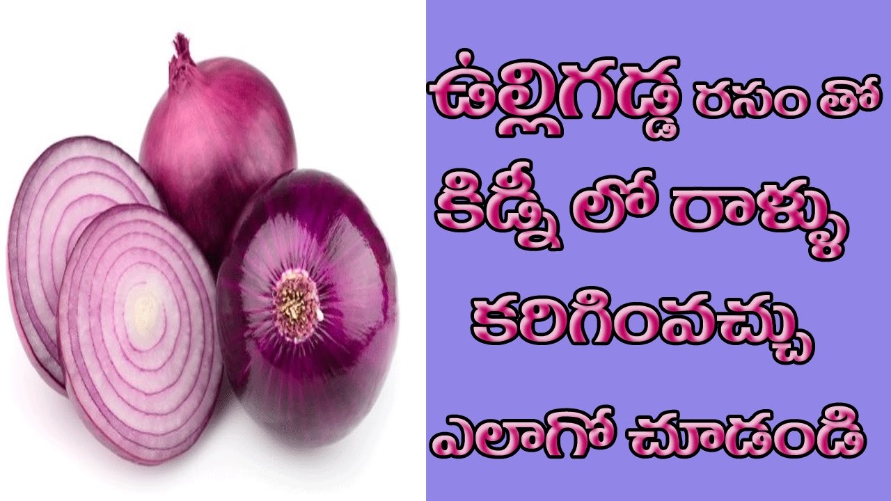 Amazing Onion Health Benefits Treating Kidney Stones And Many More