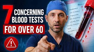 7 Blood Tests That Reveals Hidden Health Problems After 60