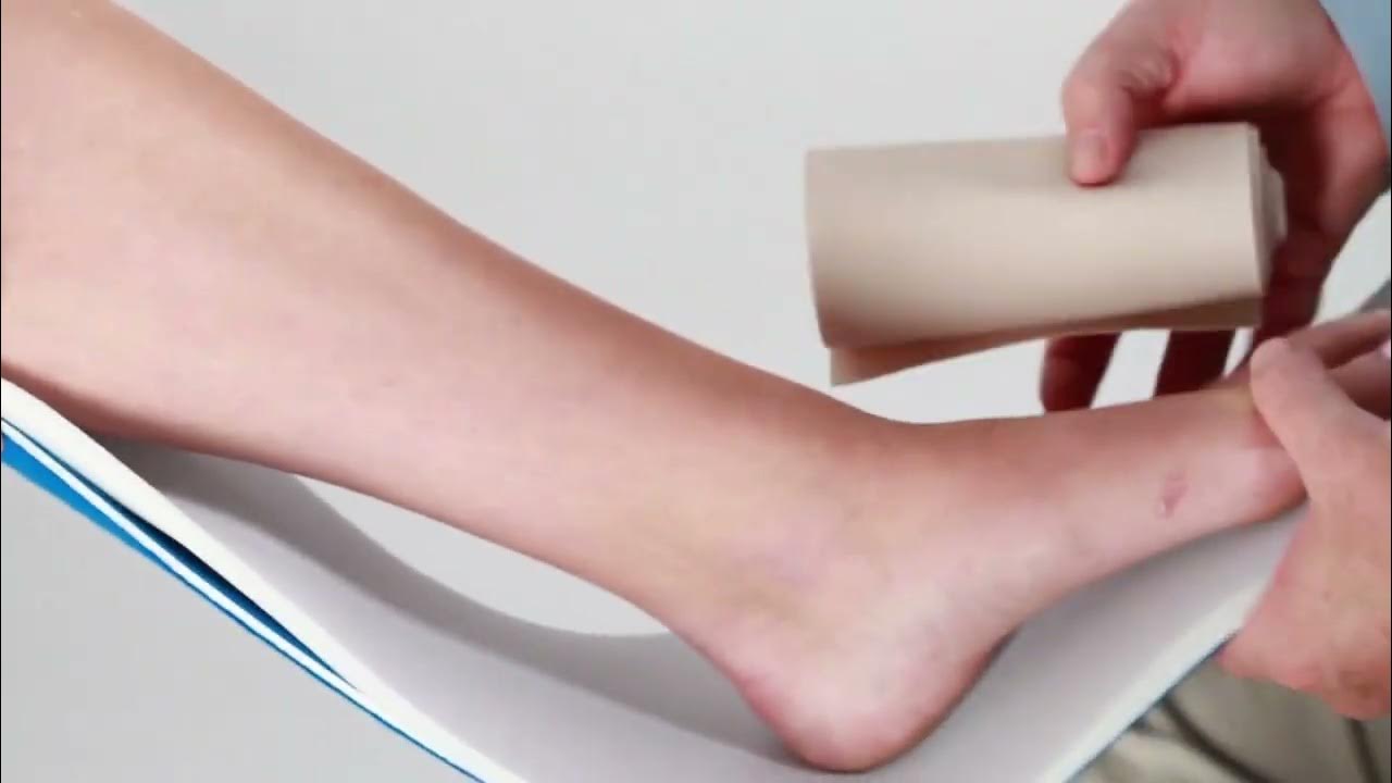 Posterior Short Leg Clinician Application Video YouTube