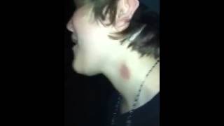 Meagans hickeys