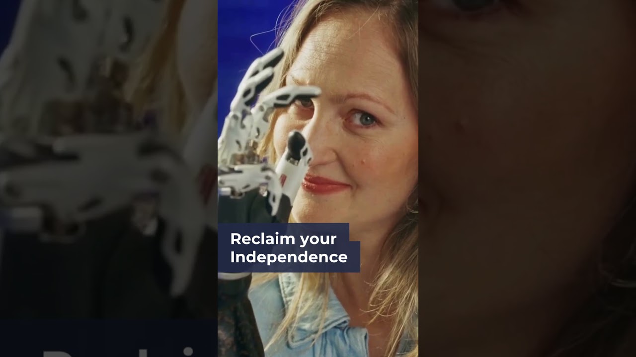 Rediscover your strength with our upper limb prosthetic care! Designed for functionality and comfort