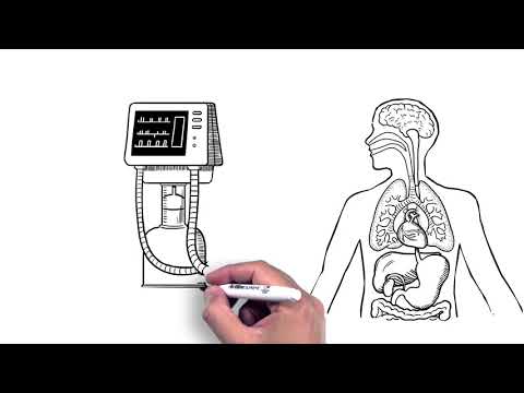 Understanding Brain Death