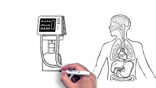 Understanding Brain Death