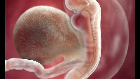 Tem como saber se o bebê tem Síndrome de Down dentro da barriga?