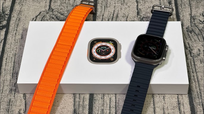 Apple Watch Designer Bands - Gucci, Louis Vuitton, Burberry, Fendi and  More! (All Under $30) 