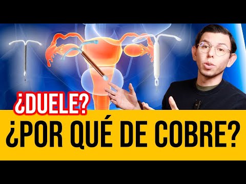 TODO sobre el DIU DE COBRE ¿Qué efectos tiene?| DrPoloGuerrero