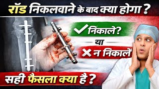 फ्रैक्चर के बाद डली रॉड निकालें या रहने दें? जानिए पेशेंट की ज़ुबानी | LIVE with Doctor 🔥💯