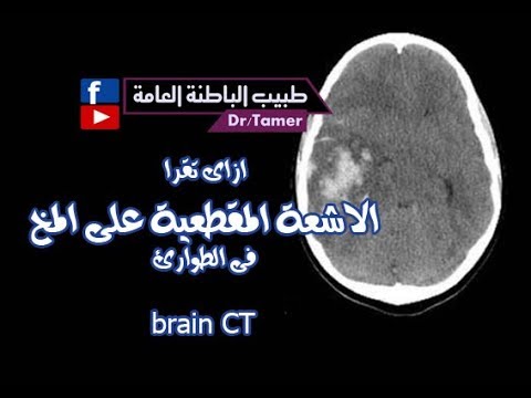 اشعة مقطعية للراس