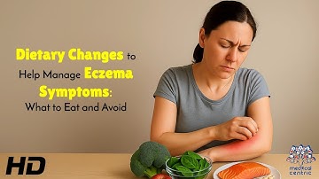 Dietary Changes to Help Manage Eczema Symptoms for Long Term Relief