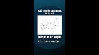Você Também Acha Difícil Tratar Classe Iii?