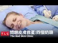《問題皮膚救星》四個奶頭？！每18個人就有1個人個人會有多的奶頭｜TLC 旅遊生活頻道