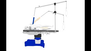 Mesa Para Artroscopia Por Inestabilidad De Hombro