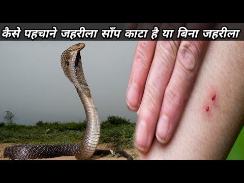 कैसे पहचाने जहरीला सांप काटा है या बिना जहरीला !!snakebite!!