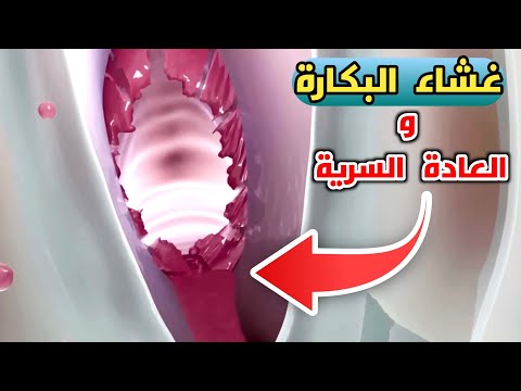 تمزق غشاء البكارة اثناء العادة السرية مهم جداا    