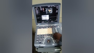 ultrasound color Doppler ge voluson e thyroid+carotid