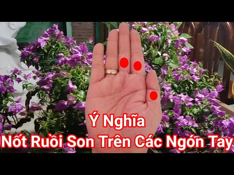 #Shorts Bàn Tay Có Hai "Vân Đuôi Cá" Và Nốt Ruồi Son Trên Các Ngón Tay, ZaLo 0347185898