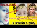 Наращивание ресниц БЕЗ ПЕРЕРЫВА 1 год! ПОСЛЕДСТВИЯ. Мой опыт