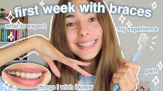 my first week with braces.. (what to expect, things i wish i knew, tips, etc)