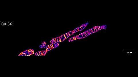 Time-lapse STED imaging of a rapid inter-cristae mergence in a single mitochondrion.