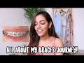 All about my braces journey | Q&A cost, duration, treatment, ceramic, Invisalign or metallic type