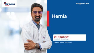 Hernia Dr Ritesh G V, Narayana Hospital, Hsr