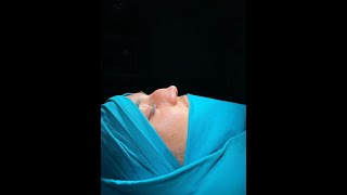 افضل نتائج عمليات تجميل الانف في تركيا لعام 2022 #تجميل_الانف #rhinoplasty #تصغير الانف