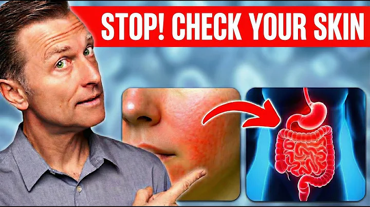 Your Skin Is WARNING You Don’t Ignore This!