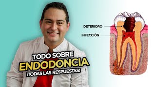 ENDODONCIA: TODO lo que necesitas saber sobre los tratamientos de conductos o Root Canal.