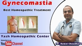 Get permanent relief from Gynecomastia without operation