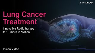 Lung Cancer Treatment – Innovative Radiotherapy for Tumors in Motion