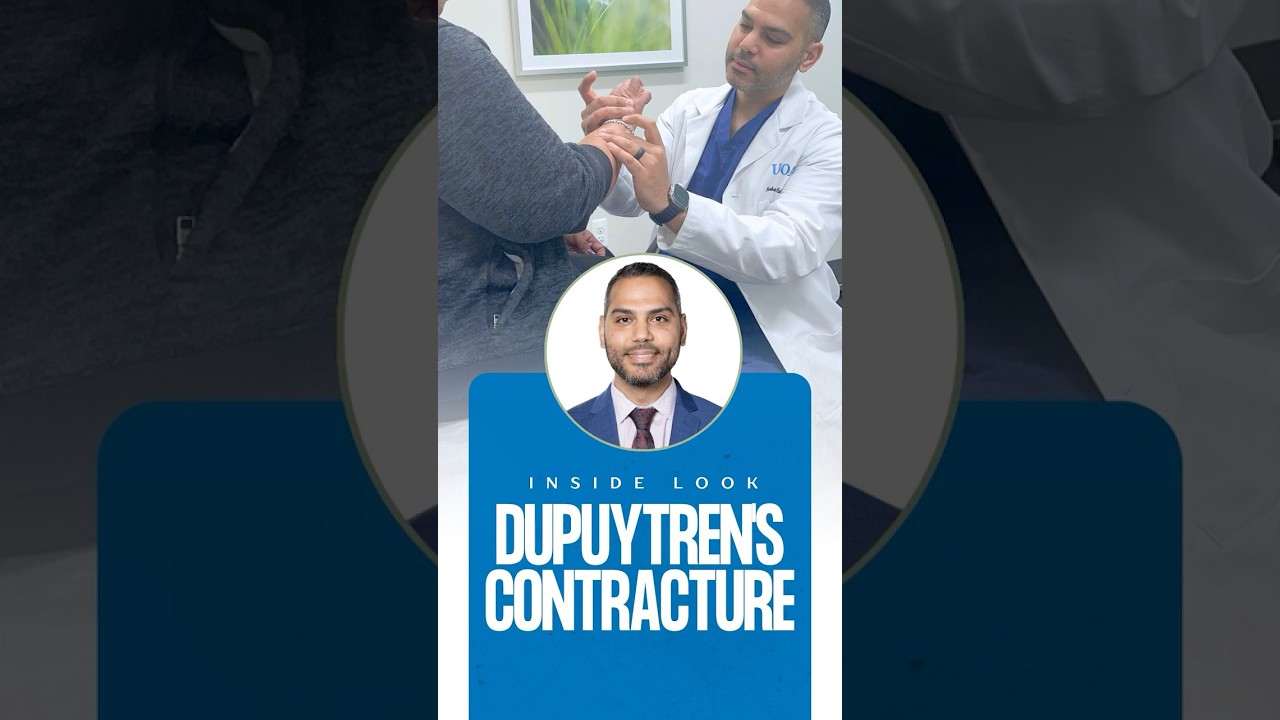 Inside Look: Dupuytren's Contracture