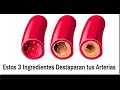 Limpia Tus Arterias Coronarias Con Sólo 3 Ingredientes