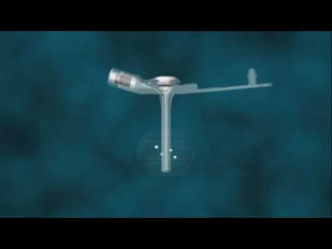Introduction To The Amt Minione Balloon Button Youtube