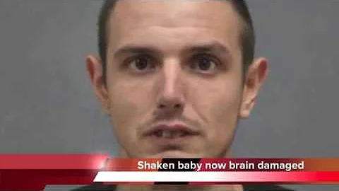Baby shaken until eyes detached - James Casteel ar...