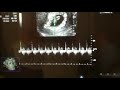 Paciente con Ovarios Poliquísticos logró embarazo con FIV
