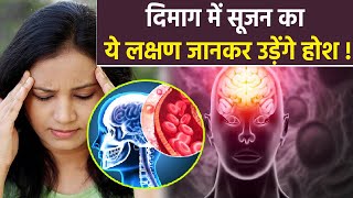 दमग म सजन कय हत ह , दमग म सजन क य लकषण जनकर उडग हश Boldskyhealth