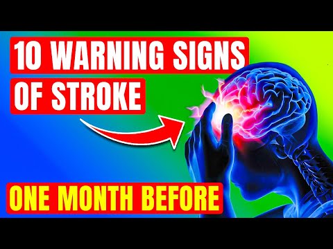 Stroke Warning Signs: Know These 10 Signs To Save A Life