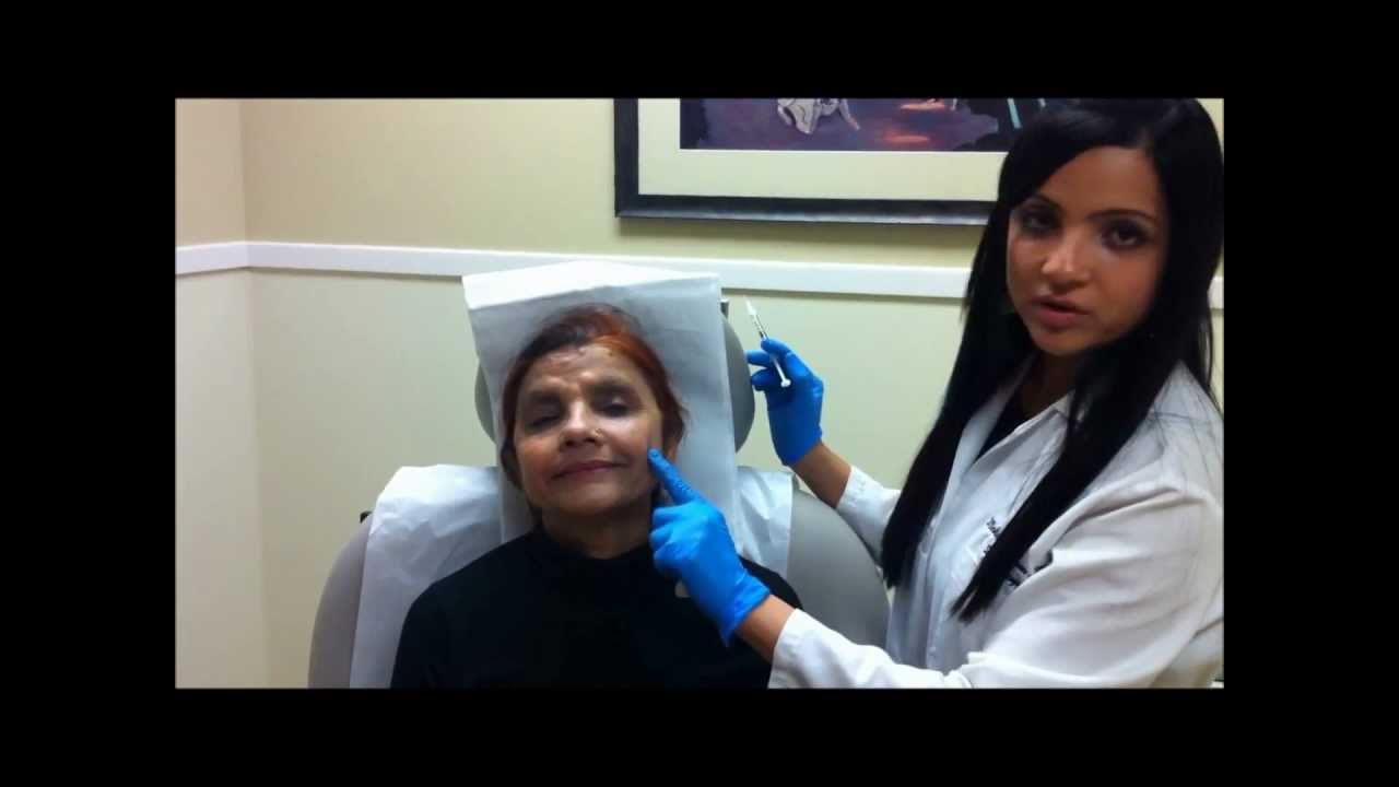 Minnesota dermatolgist performs subtle Botox for Facial Rejuvenation