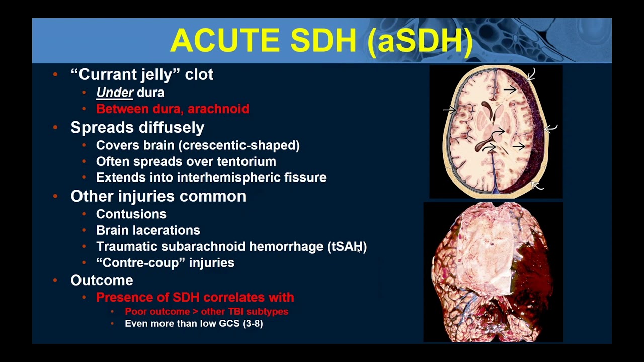 Intro To Common Causes Of Intracranial Pathology Part1 Dr Anne Osborn intro-to-common-causes-of-intracranial-pathology-part1-dr-anne-osborn