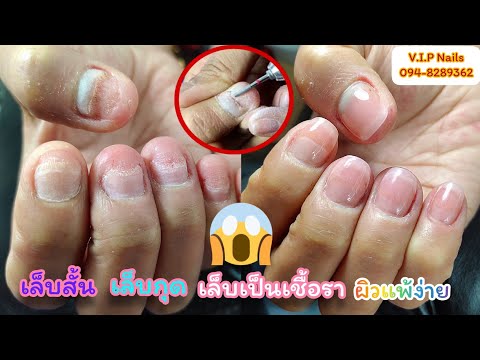 วิธีต่อเล็บมีปัญหา เล็บสั้น เล็บกุด เล็บเป็นชื้อรา ผิวแพ้ง่าย รวมไปถึงวิธีการดูแลเล็บจร้า