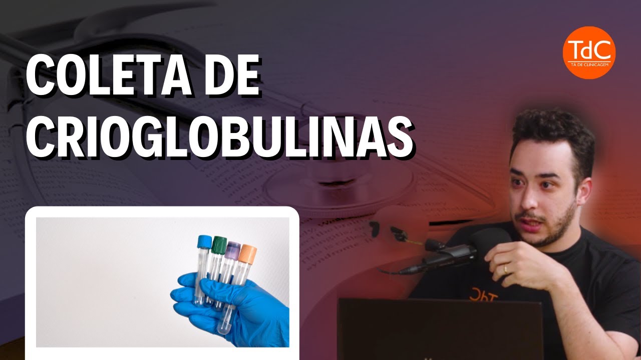 Thumbnail - Crioglobulinemia - Como coletar as crioglobulinas?