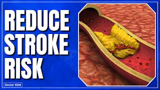 8 Things You Can Do TODAY To Reduce Your Stroke Risk