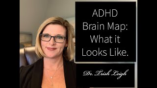 ADHD Brain Map: What it Looks Like.