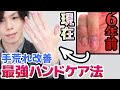僕のボロボロ手荒れを改善した【最強ハンドケア法】　市販ハンドクリームで手荒れが治まらない人、簡単ひと手間『Wハンドケア』試してみて！