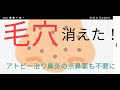 鼻の毛穴が消えた！パンを餅に変えた結果が凄すぎた！子供の頃からの悩みの○○も消えたし○○○も必要なくなった！