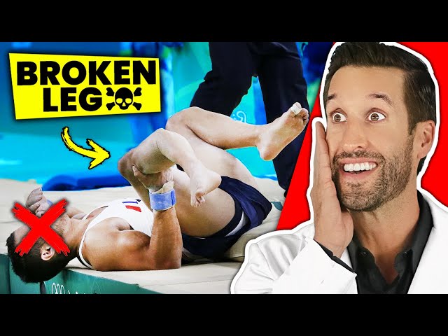5 MOST PAINFUL Bone Breaks You Can EVER Experience! class=